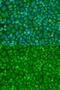 Eukaryotic Translation Initiation Factor 4E antibody, GTX32580, GeneTex, Immunofluorescence image 