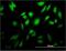 Testis Associated Actin Remodelling Kinase 2 antibody, H00010420-M02, Novus Biologicals, Immunofluorescence image 