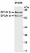 LIM Domain And Actin Binding 1 antibody, NB100-2310, Novus Biologicals, Immunoprecipitation image 