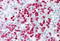 S100 Calcium Binding Protein A8 antibody, MBS245035, MyBioSource, Immunohistochemistry paraffin image 