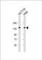 Ankyrin Repeat And Sterile Alpha Motif Domain Containing 1A antibody, PA5-72161, Invitrogen Antibodies, Western Blot image 