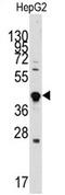 Growth Differentiation Factor 3 antibody, AP11943PU-N, Origene, Western Blot image 