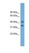 Family With Sequence Similarity 118 Member A antibody, NBP1-57051, Novus Biologicals, Western Blot image 