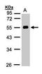 Angiotensinogen antibody, TA308844, Origene, Western Blot image 
