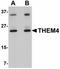 Thioesterase Superfamily Member 4 antibody, orb94288, Biorbyt, Western Blot image 