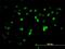 Zinc Finger Protein 496 antibody, H00084838-M08, Novus Biologicals, Immunofluorescence image 