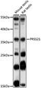 Serine Protease 21 antibody, 16-429, ProSci, Western Blot image 