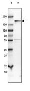 Neurofilament Medium antibody, NBP2-46619, Novus Biologicals, Western Blot image 