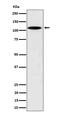 NEDD4 Binding Protein 1 antibody, M12575, Boster Biological Technology, Western Blot image 