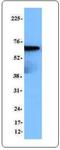 Spleen Associated Tyrosine Kinase antibody, TA327963, Origene, Western Blot image 