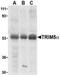 Tripartite Motif Containing 5 antibody, NBP1-76601, Novus Biologicals, Western Blot image 