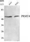 Coactivator Associated Arginine Methyltransferase 1 antibody, STJ98541, St John