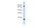 Eukaryotic Translation Initiation Factor 4 Gamma 3 antibody, 25-620, ProSci, Western Blot image 