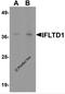 Lamin Tail Domain Containing 1 antibody, 6447, ProSci, Western Blot image 