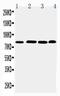 Prospero Homeobox 1 antibody, PA2229, Boster Biological Technology, Western Blot image 