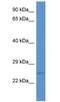 ES Cell Expressed Ras antibody, NBP1-79602, Novus Biologicals, Western Blot image 
