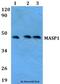 Mannan Binding Lectin Serine Peptidase 1 antibody, A02060, Boster Biological Technology, Western Blot image 