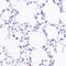 SWI/SNF Related, Matrix Associated, Actin Dependent Regulator Of Chromatin, Subfamily A, Member 4 antibody, GTX32478, GeneTex, Immunoprecipitation image 