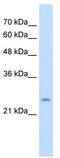 Cysteine Rich Hydrophobic Domain 1 antibody, TA335985, Origene, Western Blot image 