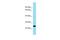 EF-Hand Calcium Binding Domain 1 antibody, A17930, Boster Biological Technology, Western Blot image 