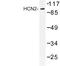 Hyperpolarization Activated Cyclic Nucleotide Gated Potassium And Sodium Channel 2 antibody, LS-C177488, Lifespan Biosciences, Western Blot image 