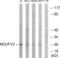 NADH:Ubiquinone Oxidoreductase Core Subunit V2 antibody, abx014631, Abbexa, Western Blot image 