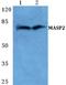 Mannan Binding Lectin Serine Peptidase 2 antibody, A02323, Boster Biological Technology, Western Blot image 