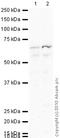 Glutamate Decarboxylase 2 antibody, ab26113, Abcam, Western Blot image 