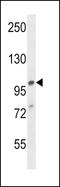 Adaptor Related Protein Complex 2 Subunit Alpha 1 antibody, LS-C156386, Lifespan Biosciences, Western Blot image 
