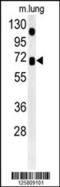 Ankyrin Repeat And SOCS Box Containing 15 antibody, 61-823, ProSci, Western Blot image 