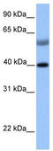 ISL LIM Homeobox 1 antibody, TA330255, Origene, Western Blot image 