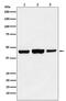 Histone acetyltransferase type B catalytic subunit antibody, M03596, Boster Biological Technology, Western Blot image 