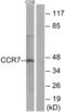 C-C Motif Chemokine Receptor 7 antibody, LS-C120557, Lifespan Biosciences, Western Blot image 