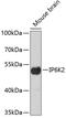 Inositol Hexakisphosphate Kinase 2 antibody, 19-456, ProSci, Western Blot image 