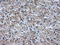ATP Synthase F1 Subunit Beta antibody, LS-C114909, Lifespan Biosciences, Immunohistochemistry paraffin image 