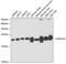 NADH:Ubiquinone Oxidoreductase Subunit S4 antibody, GTX55722, GeneTex, Western Blot image 