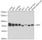 Glycyl-TRNA Synthetase antibody, A04618, Boster Biological Technology, Western Blot image 
