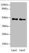 Abhydrolase Domain Containing 2 antibody, orb353755, Biorbyt, Western Blot image 