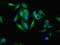 Suppressor Of Cytokine Signaling 3 antibody, LS-C396709, Lifespan Biosciences, Immunofluorescence image 