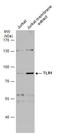 Toll Like Receptor 1 antibody, GTX130079, GeneTex, Western Blot image 