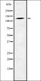 Phosphorylase Kinase Regulatory Subunit Beta antibody, orb378372, Biorbyt, Western Blot image 