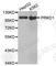 Protein Kinase D1 antibody, A0101, ABclonal Technology, Western Blot image 