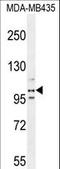 Platelet Endothelial Aggregation Receptor 1 antibody, LS-C163511, Lifespan Biosciences, Western Blot image 