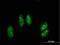 Adenosine Deaminase RNA Specific B1 antibody, H00000104-B01P, Novus Biologicals, Immunofluorescence image 