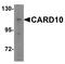 Caspase Recruitment Domain Family Member 10 antibody, NBP1-76676, Novus Biologicals, Western Blot image 