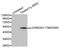 Casein Kinase 2 Alpha 1 antibody, MBS128265, MyBioSource, Western Blot image 