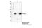 Protein Tyrosine Kinase 6 antibody, 55174S, Cell Signaling Technology, Immunoprecipitation image 