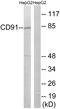 APR antibody, LS-C118336, Lifespan Biosciences, Western Blot image 