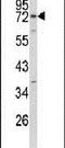 Exocyst Complex Component 5 antibody, PA5-26024, Invitrogen Antibodies, Western Blot image 