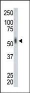 MAP kinase-interacting serine/threonine-protein kinase 2 antibody, PA5-13809, Invitrogen Antibodies, Western Blot image 